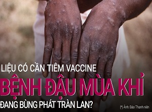Đậu mùa khỉ không gây đại dịch, liệu Việt Nam có cần tiêm Vaccine?